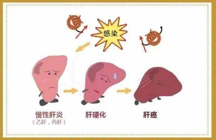 我省启动消除肝炎危害行动